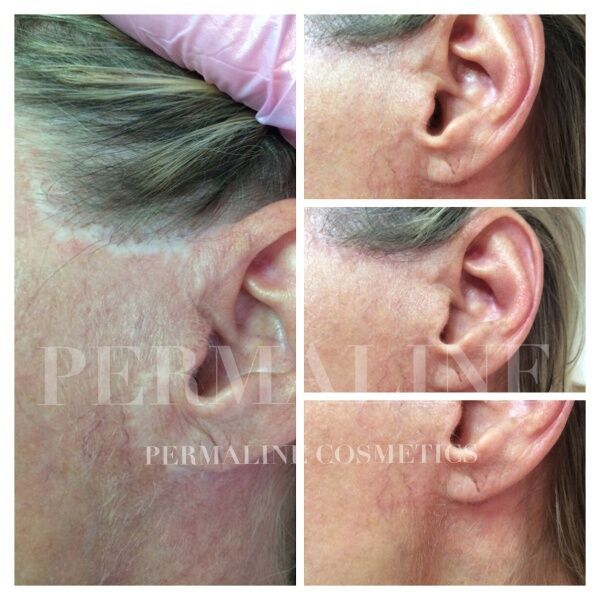 Micropigmentation Before & After