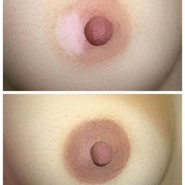 Micropigmentation Before & After