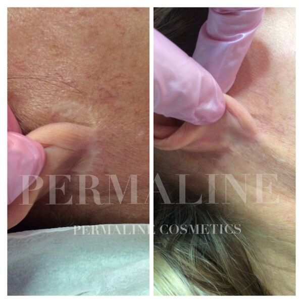 Micropigmentation Before & After