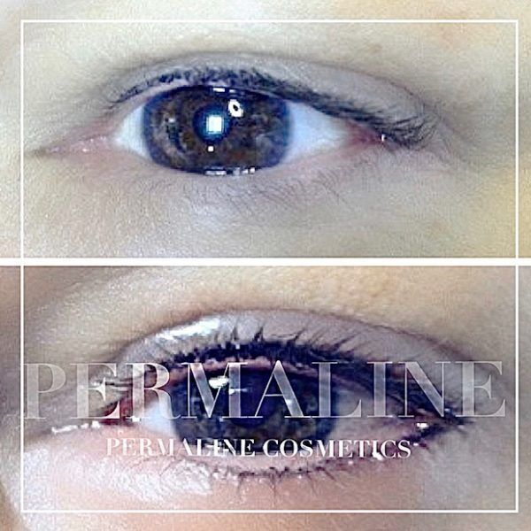 Lashline Enhancement Before & After